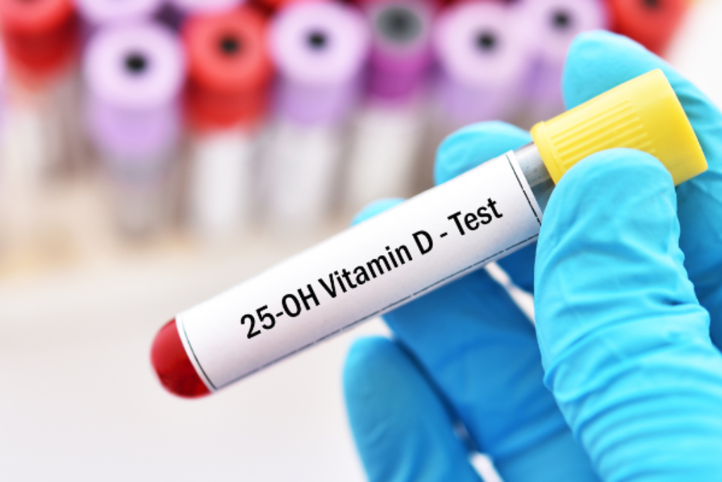 Exame de Vitamina D-25 Hidroxi